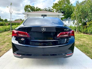 2015 Acura TLX thumbnail – Miami, FL – 16